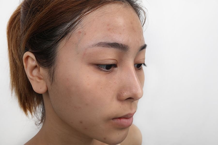 干燥的皮肤, 30岁以后,斑点,干纹,毛孔粗大就轮番轰炸,脸上永远都脏脏