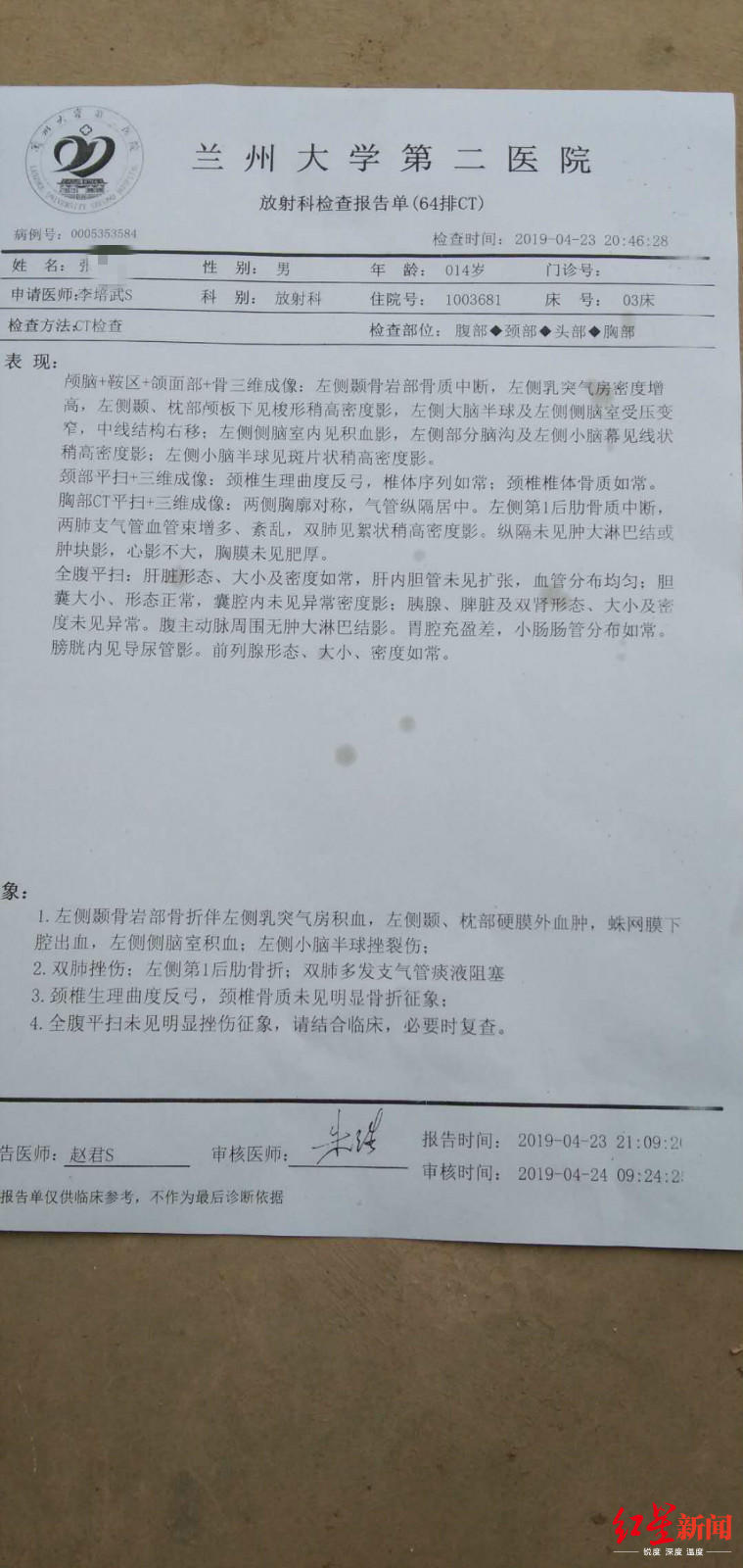 据其提供的兰州大学第二医院检查报告单显示,张某左侧颞骨岩部骨折伴