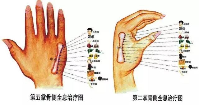 看懂这张图,穴位不用找(人体全息图)