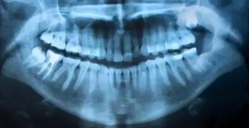 人间地狱切尔诺贝利，现在已经“鸟语花香”