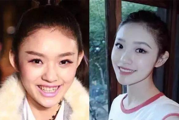 乔欣杨洋恋情再添锤，前任李沁发博暗示，但她一张嘴就输给乔欣了