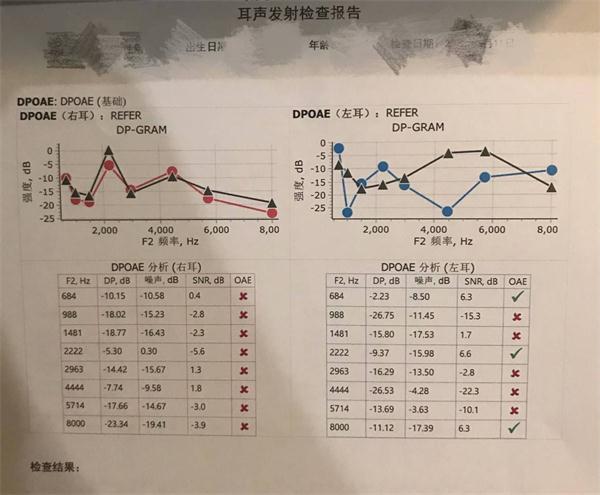 职业健康检查|一文教你了解听力测试那些事儿