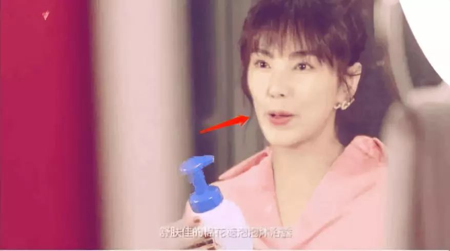 张雨绮新脸比马脸还长，眼角开到山根是多想不开？