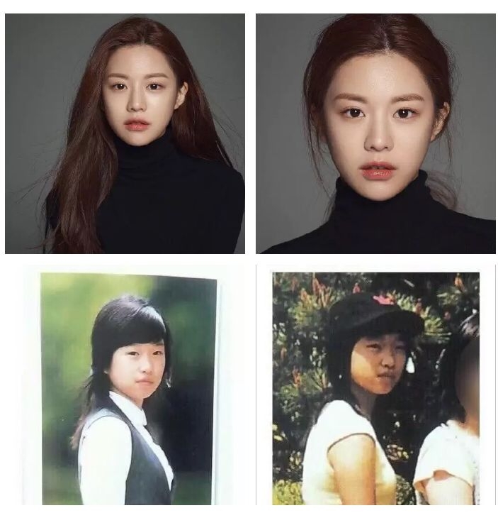 盘点女明星整容事件，最蠢的是为爱整容