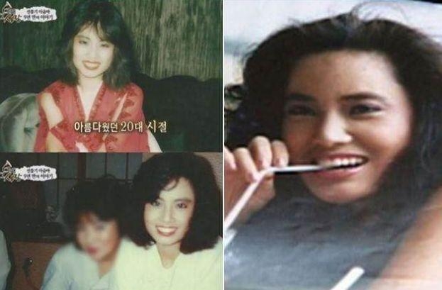 韩国美女明星整容上瘾，导致脸部变形毁容，睡觉都无法闭上眼！