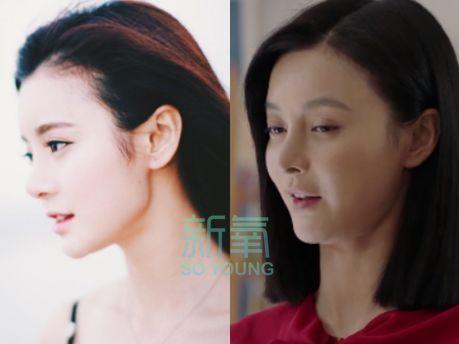 王凯初恋整成低配版沈梦辰！连她整形后遗症的朝天鼻也照搬了···