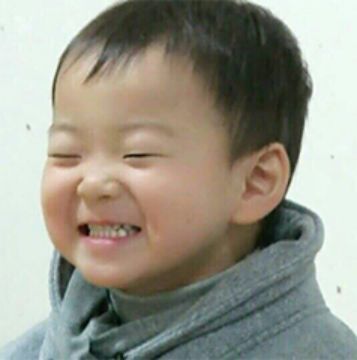 迷死氧亲身体验，我去日本整了一个纯天然鼻子