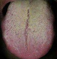 被男主角吐槽演吻戏不刷牙,口臭到拍不下去··· 白瞎了这个颜值惹!