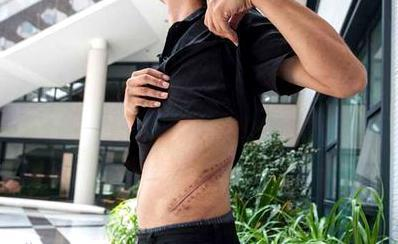 八年前卖肾买iPhone的少年 如今还好吗?