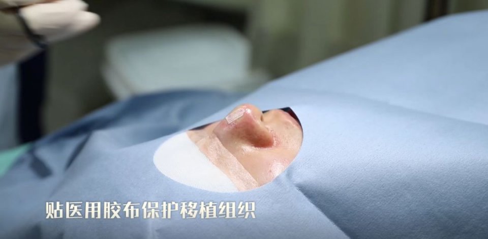 迷死氧日本亲身体验2，我用脖子上的皮给自己缝了毛孔