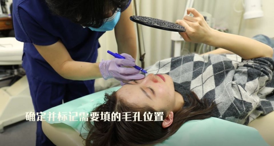 迷死氧日本亲身体验2，我用脖子上的皮给自己缝了毛孔