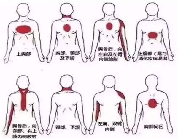 冠心病的症状