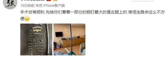 张云雷左腿取出十公分钢钉 郭德纲一句话暴露两人关系