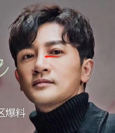 苏有朋把自己整成林峯！为什么男人这么爱动下巴？！