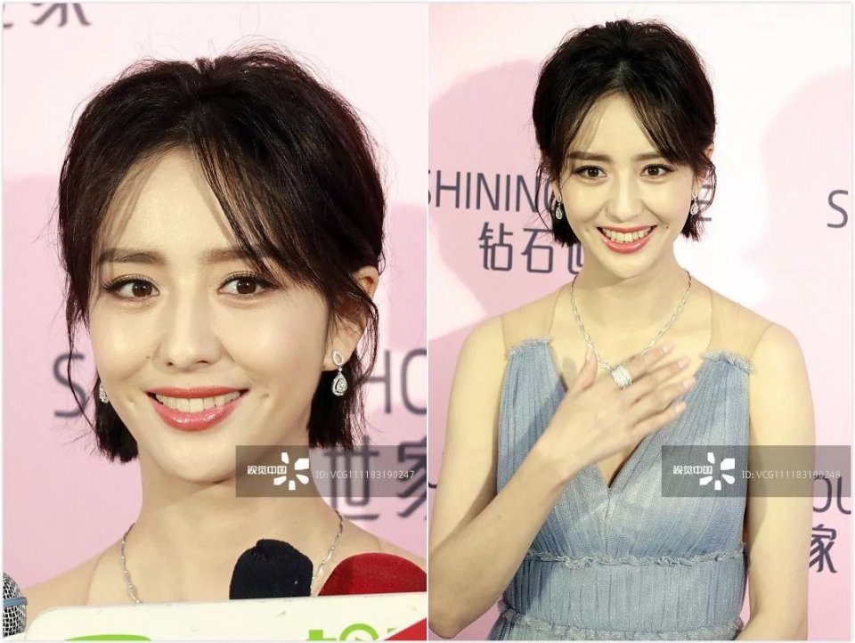 佟丽娅的脸是怎么了，一笑咋崩成这样了呢？