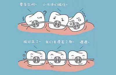 说好的恒牙呢,为什么没能永恒?