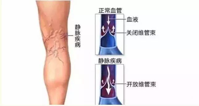 李宇春粉嫩纱裙又美又仙！但却意外暴露真实腿型，太惨烈了