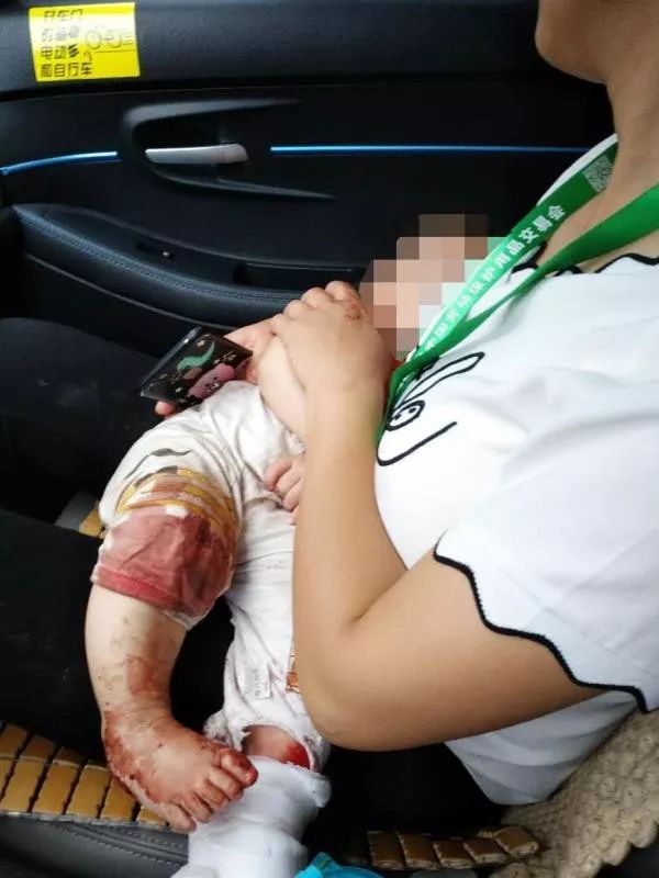 广州这个5月龄宝宝伤可见骨，浑身是血的妈妈路上求救，等来的是……