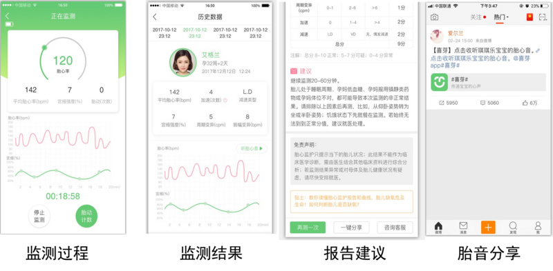 多普勒家用胎心仪商业化不及预期，「喜芽」的远程听诊式产品能否破局？