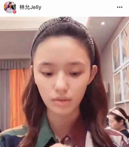 林允的大小眼已经严重到变成“肌无力”了···