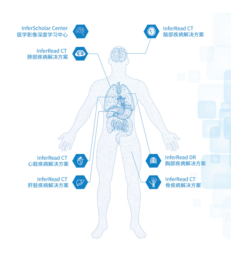 36氪首发 | AI医疗赛道加速洗牌，「推想科技」获C1轮融资后继续加强产品研发
