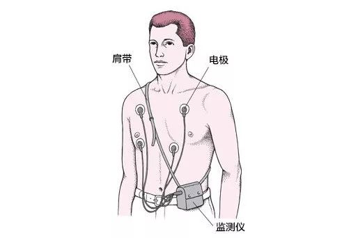 Apple Watch心电图功能救人一命!被唱衰的它能否“起死回生”?| 智能生活
