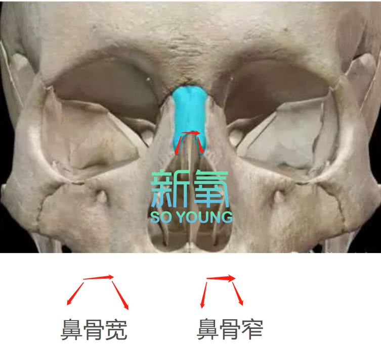 送命题:娄艺潇刚补完针的气球脸,杨蓉宽成护城河的新鼻子,你选谁?