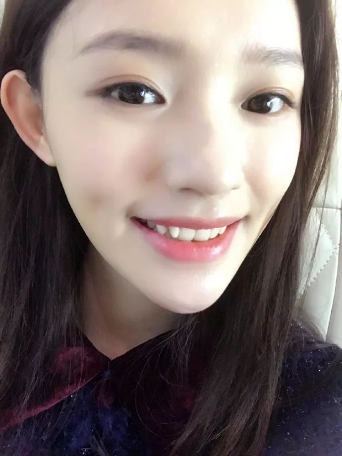 林允的牙套脸又严重了！这次直接变成五边形…