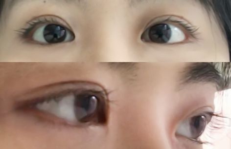 她们的18岁成人礼：一批新鼻子