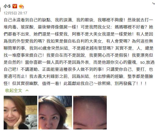 小s自曝脸上的肉毒杆菌和玻尿酸快消失了，她为此感到开心