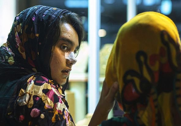 12岁整鼻到20岁还没拆绷带，只是为了炫富？