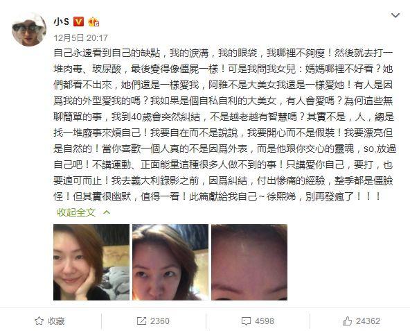 不仅小S自曝打针！王思聪前女友被指脸崩认不出！！！