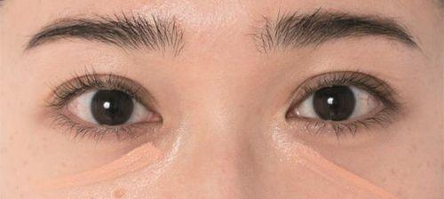 遮瑕全科普|黑眼圈、泪沟、痘痘……通通退散!