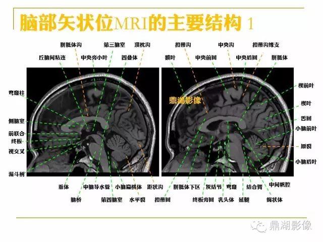 超详细头颅mr高清解剖(必点收藏)