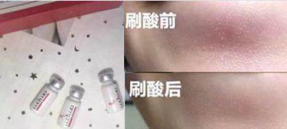 为啥热巴玩网红滤镜翻车，娜扎却完美hold住？