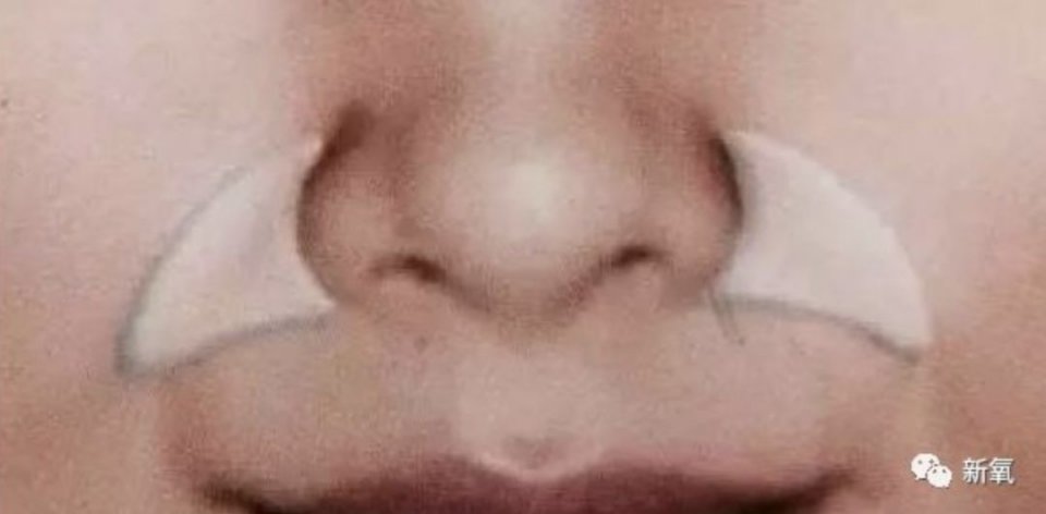 张雨绮鼻子歪到天边的视频都敢往外发！团队是集体造反了？