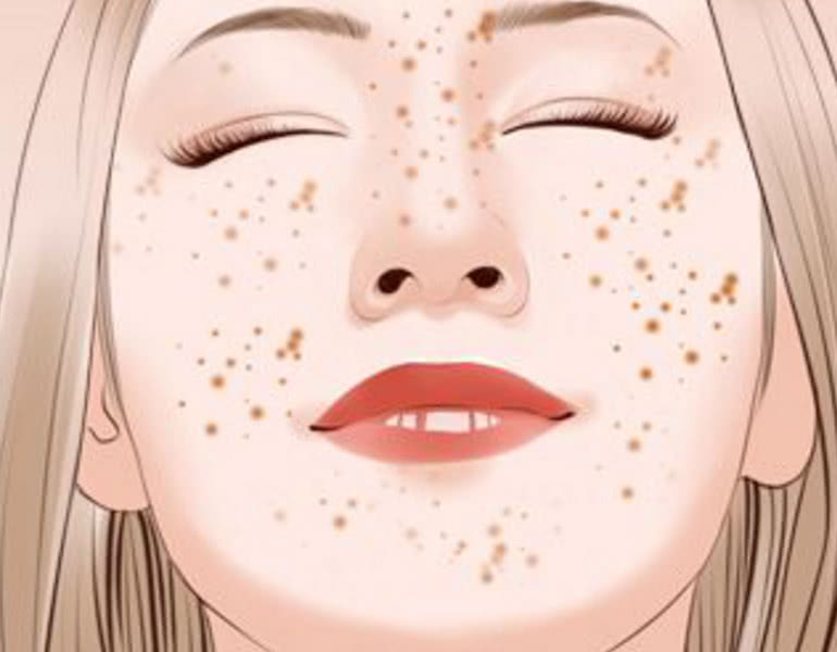 祛黄褐斑，与其喝“上百斤”中药，还不如用3物，很日常的东西