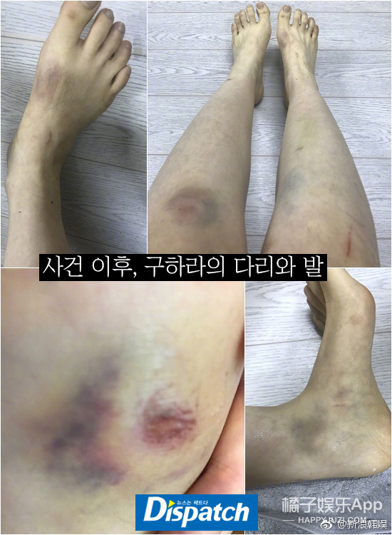 为了这种渣男自杀，真的不值得！
