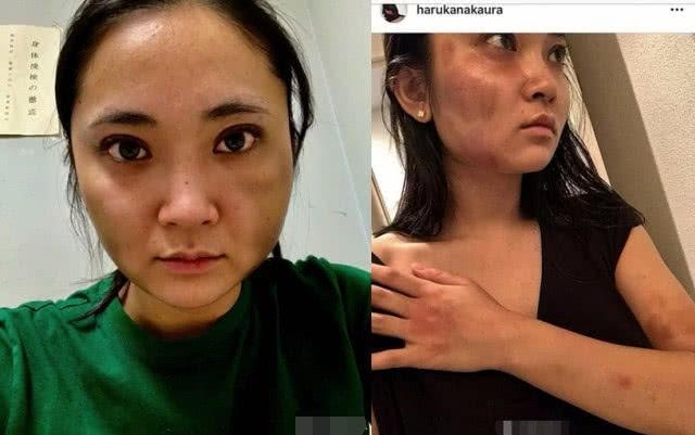 心理扭曲？日媒曝蒋劲夫不仅家暴还虐狗，多次摔打踩踏女友爱犬