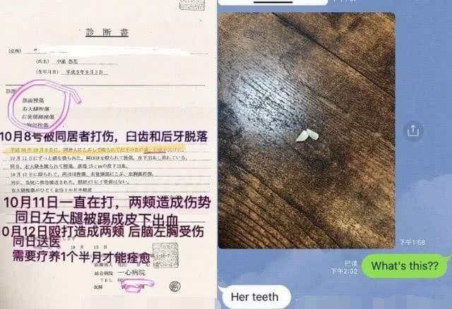 心理扭曲？日媒曝蒋劲夫不仅家暴还虐狗，多次摔打踩踏女友爱犬