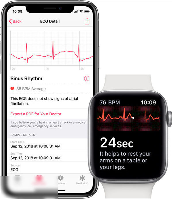 ecg iwatch