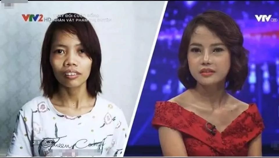 越南丑女逆袭记