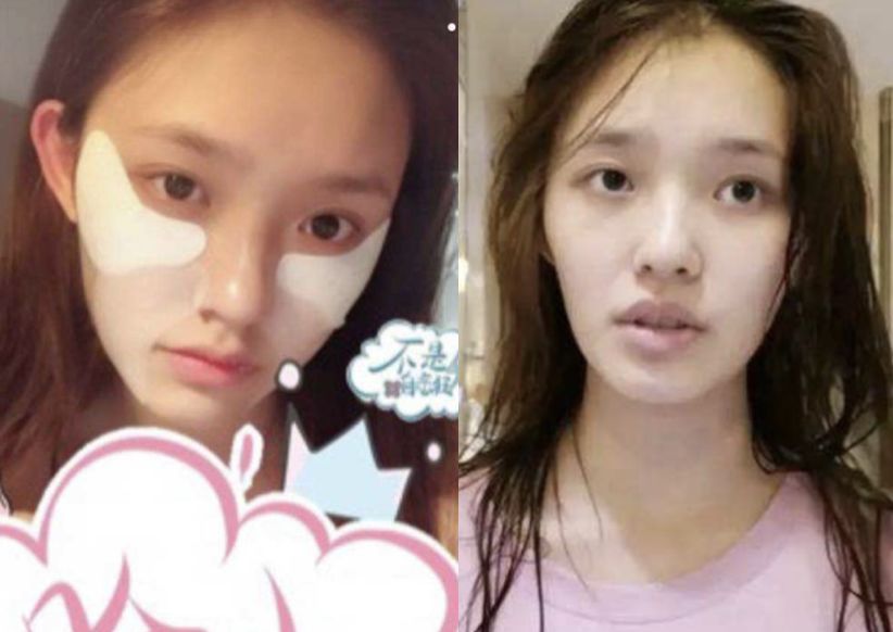 可怕！当红女明星脸上集体出现了这个东西！