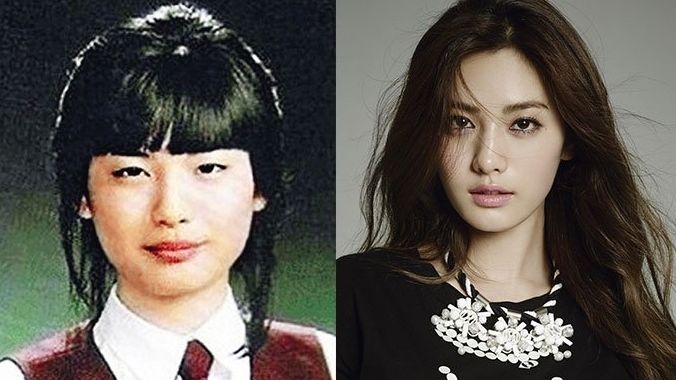 超越刘亦菲连续两年被评为亚洲最美的她，突然肿成这样了？