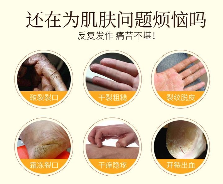 手脚爆皮、开裂?一瓶泰国古方修护膏全部解决