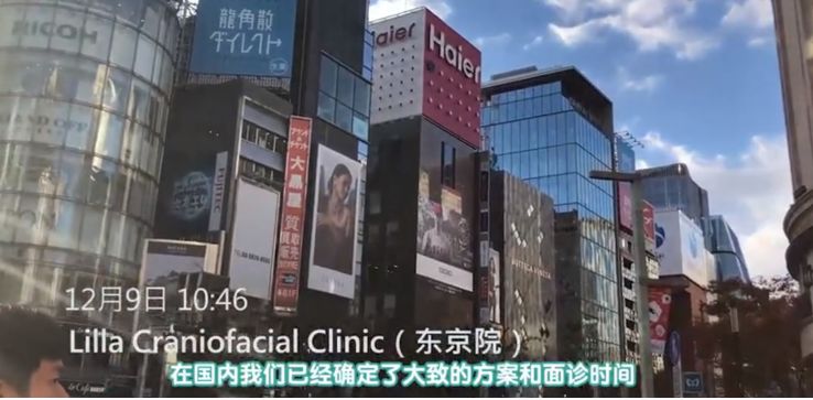 迷死氧亲身体验，我去日本整了一个纯天然鼻子