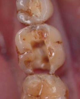 被男主角吐槽演吻戏不刷牙,口臭到拍不下去··· 白瞎了这个颜值惹!