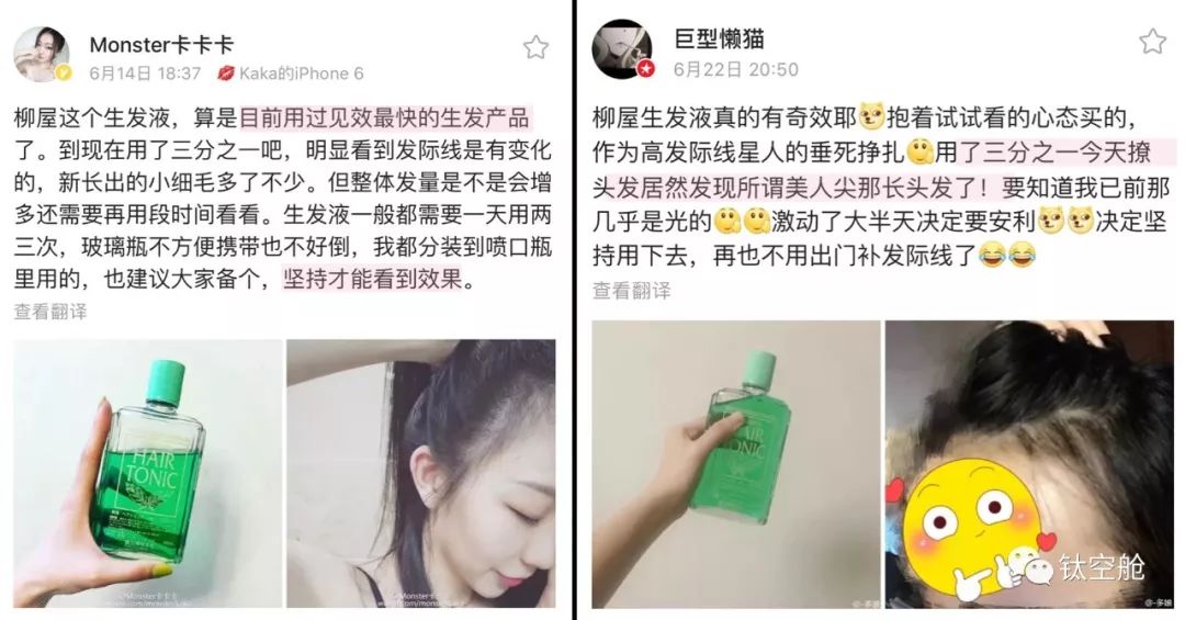 你连头发都没有，还敢“龙抬头”？两款“生发利器”可以拯救发际线 | 钛空舱