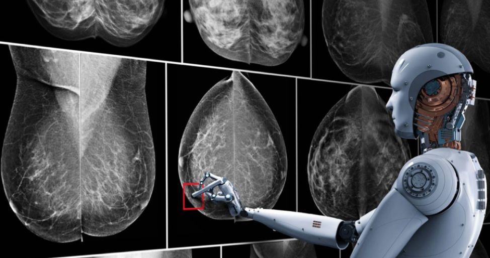 AI，会让放射科医生下岗吗？