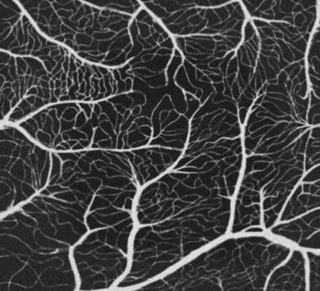 想完成中高端眼科器械的进口替代，「图湃影像」自主研发扫频 OCT 视网膜诊断系统